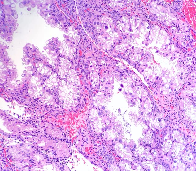 Endometrial Biopsy Course