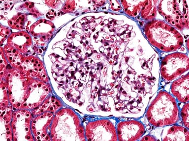 Renal Biopsy